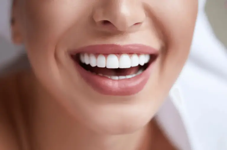 gülüş tasarımı hollywood smile