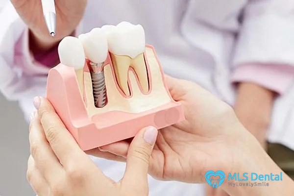 implant-tedavi-ağrısı