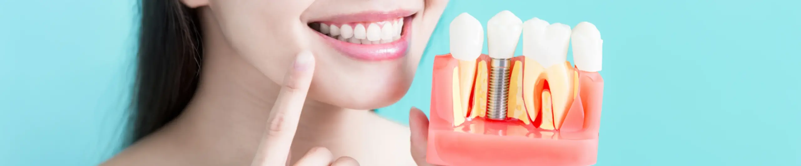 implant-tedavi-sonrası-ağrı